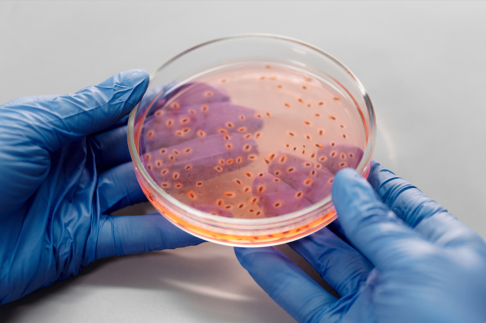 Recombinant Enzymes