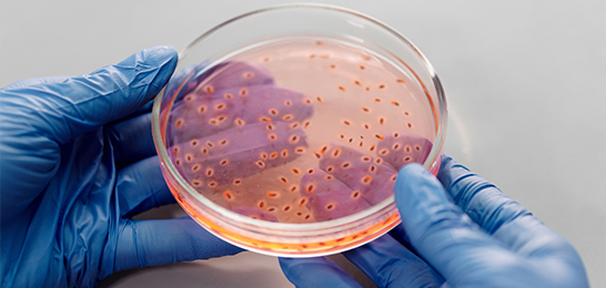 Recombinant Enzymes