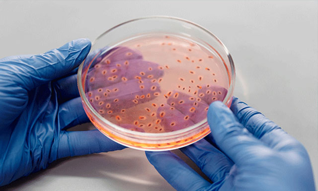 Recombinant Enzymes